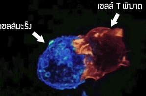 เซลล์Tพิฆาต กำจัดเซลล์มะเร็ง
